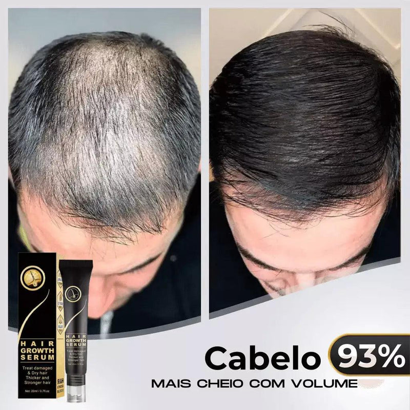 Repair Hair® | Crescimento Capilar e Combate à Queda de Cabelo